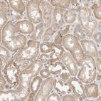 Immunohistochemical staining of human kidney shows moderate cytoplasmic-membranous positivity in cells in tubules.
