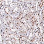 Immunohistochemical staining of human kidney shows moderate nuclear/nuclear membranous positivity in cells in tubules.