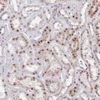 Immunohistochemical staining of human kidney shows moderate nuclear/nuclear membranous positivity in cells in tubules.