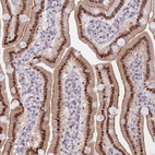 Immunohistochemical staining of human duodenum shows strong nuclear/nuclear membranous positivity in glandular cells.