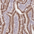 Immunohistochemical staining of human duodenum shows strong nuclear/nuclear membranous positivity in glandular cells.