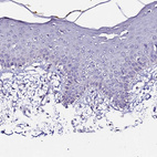 Immunohistochemical staining of human skin shows no positivity in squamous epithelial cells as expected.