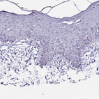 Immunohistochemical staining of human skin shows no positivity in squamous epithelial cells as expected.