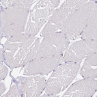 Immunohistochemical staining of human skeletal muscle shows no positivity in myocytes as expected.