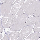 Immunohistochemical staining of human skeletal muscle shows no positivity in myocytes as expected.