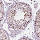 Immunohistochemical staining of human testis shows moderate nuclear/cytoplasmic nuclear positivity in cells in seminiferous ducts.