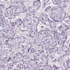 Immunohistochemical staining of human placenta shows no positivity in trophoblastic cells as expected.