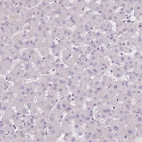 Immunohistochemical staining of human liver shows no positivity in hepatocytes as expected.