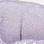 Immunohistochemical staining of human skin shows no positivity in squamous epithelial cells as expected.