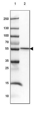 Lane 1: Marker [kDa] 250, 130, 100, 70, 55, 35, 25, 15, 10_br/_Lane 2: Human Skeletal muscle tissue