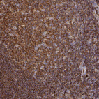 Immunohistochemical staining of human tonsil tissue shows strong cytoplasmic membranous positivity in germinal center cells.