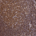 Immunohistochemical staining of human tonsil tissue shows strong cytoplasmic membranous positivity in germinal center cells.
