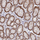 Immunohistochemical staining of human stomach shows moderate cytoplasmic membranous positivity in glandular cells.