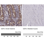 Anti-EZR Antibody