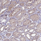 Immunohistochemical staining of human kidney shows weak cytoplasmic positivity in cells in tubules.