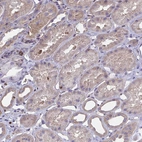 Immunohistochemical staining of human kidney shows weak cytoplasmic positivity in cells in tubules.