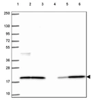 Lane 1: Marker [kDa] 250, 130, 95, 72, 55, 36, 28, 17, 10_br/_Lane 2: Human cell line RT-4_br/_Lane 3: Human cell line U-251 MG_br/_Lane 4: Human plasma_br/_Lane 5: Human Liver tissue_br/_Lane 6: Human Tonsil tissue
