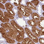 Immunohistochemical staining of human kidney shows strong cytoplasmic nucleus positivity in cells in tubules.