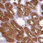 Immunohistochemical staining of human kidney shows strong cytoplasmic nucleus positivity in cells in tubules.