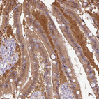 Immunohistochemical staining of human duodenum shows moderate cytoplasmic nucleus positivity in glandular cells.