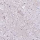 Immunohistochemical staining of human skeletal muscle shows no positivity in myocytes as expected.