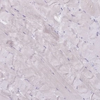 Immunohistochemical staining of human skeletal muscle shows no positivity in myocytes as expected.