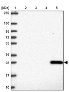 Lane 1: Marker [kDa] 250, 130, 95, 72, 55, 36, 28, 17, 10_br/_Lane 2: Human cell line RT-4_br/_Lane 3: Human cell line U-251 MG_br/_Lane 4: Human plasma_br/_Lane 5: Human Liver tissue