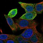 Immunofluorescent staining of human cell line Hep G2 shows localization to cytosol.
