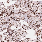 Immunohistochemical staining of human placenta shows strong nuclear positivity in trophoblastic cells and decidual cells.