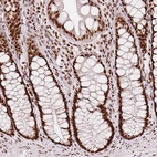 Immunohistochemical staining of human colon shows strong nuclear positivity in glandular cells and lymphoid cells.