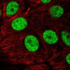 Immunofluorescent staining of human cell line MCF7 shows localization to nucleoplasm.