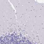 Immunohistochemical staining of human cerebellum shows no positivity in Purkinje cells as expected.