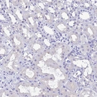 Immunohistochemical staining of human kidney shows no positivity in cells in tubule as expected.