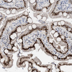 Immunohistochemical staining of human duodenum shows strong nuclear positivity in glandular cells in addition to weak cytoplasmic positivity.
