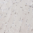Immunohistochemical staining of human skeletal muscle shows strong nuclear positivity in myocytes in addition to weak cytoplasmic positivity.