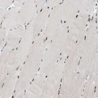 Immunohistochemical staining of human skeletal muscle shows strong nuclear positivity in myocytes in addition to weak cytoplasmic positivity.