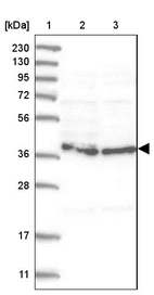 Lane 1: Marker [kDa] 230, 130, 95, 72, 56, 36, 28, 17, 11_br/_Lane 2: Human cell line RT-4_br/_Lane 3: Human cell line U-251MG sp