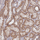 Immunohistochemical staining of human kidney shows moderate cytoplasmic membranous positivity in cells in tubules.