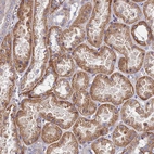 Immunohistochemical staining of human kidney shows moderate cytoplasmic membranous positivity in cells in tubules.