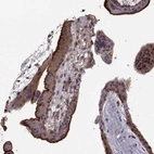 Immunohistochemical staining of human placenta shows strong positivity in apical membrane in trophoblastic cells.
