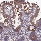 Immunohistochemical staining of human small intestine shows moderate cytoplasmic membranous positivity in glandular cells.