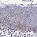 Immunohistochemical staining of human skin shows weak cytoplasmic positivity in squamous epithelial cells.