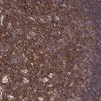 Immunohistochemical staining of human tonsil shows strong membranous positivity in germinal center cells.