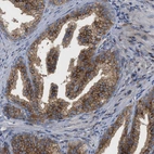 Immunohistochemical staining of human prostate shows moderate cytoplasmic membranous positivity in glandular cells.