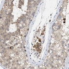 Immunohistochemical staining of human testis shows moderate cytoplasmic membranous positivity in Leydig cells and weak cytoplasmic membranous positivity in cells in seminiferous cells.
