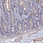 Immunohistochemical staining of human duodenum shows strong membranous positivity in endothelial cells and weak cytoplasmic membranous positivity in glandular cells.