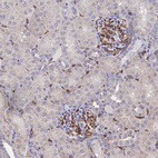 Immunohistochemical staining of human kidney shows moderate membranous-cytoplasmic positivity in cells in glomeruli and endothelial cells.