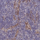 Immunohistochemical staining of human lymphoid tissues shows moderate membranous-cytoplasmic positivity in endothelial cells.