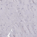 Immunohistochemical staining of human skeletal muscle shows no positivity in striated muscle fibers as expected.