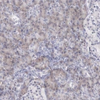 Immunohistochemical staining of human pancreas shows moderate cytoplasmic positivity in exocrine glandular cells.